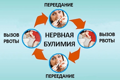 Лечение булимии в Ульяновске